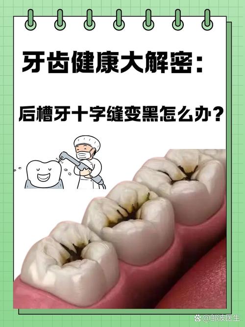 牙上长黑点解决方法-图2