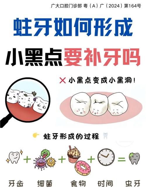 牙上长黑点解决方法-图3