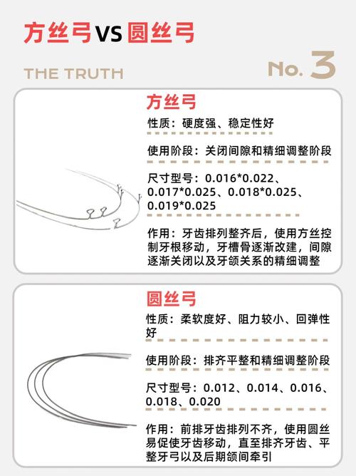 正畸方丝和直丝的区别-图1