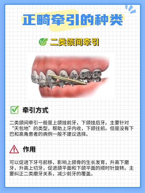 正畸中二类牵引的作用机制及临床应用效果是什么？-图2