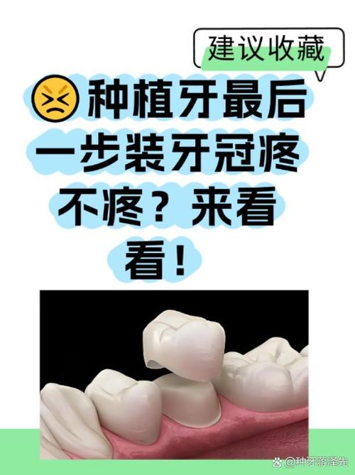 种牙后牙冠怎么戴?详细步骤有哪些?-图1 种牙后牙冠怎么戴?详细步骤有哪些?-图1