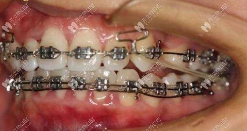 方丝扭转器使用方法是什么?详细操作步骤指南-图2 方丝扭转器使用方法是什么?详细操作步骤指南-图2