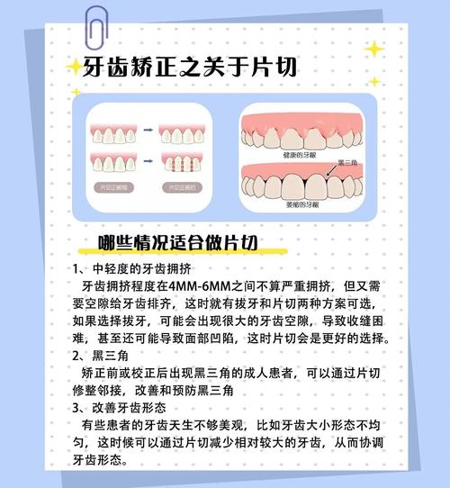 侧切牙缺失修复方法-图1 侧切牙缺失修复方法-图1