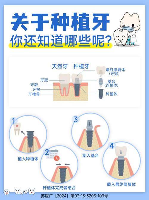 牙种植植骨的方法有哪些？不同方法如何选择与应用？-图3