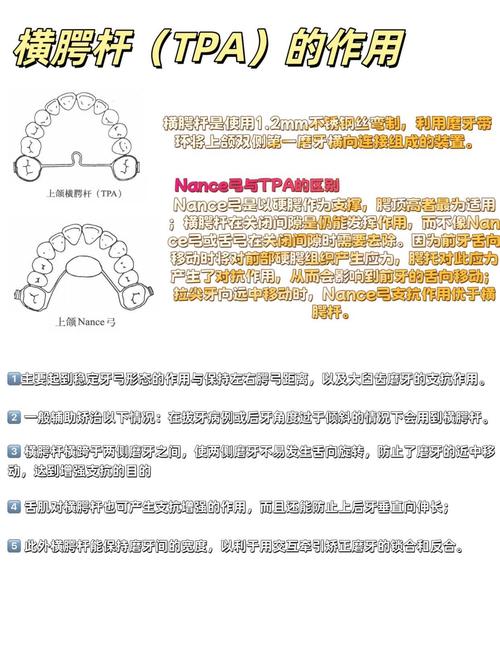 正畸一类牵引的分类有哪些具体类型?-图1 正畸一类牵引的分类有哪些具体类型?-图1