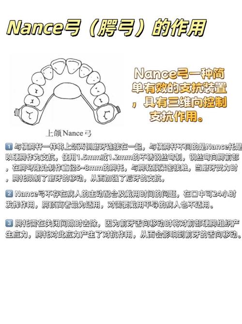 正畸一类牵引的分类有哪些具体类型？-图2