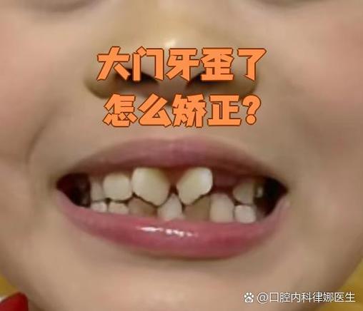 正畸推簧为何会把门牙顶歪？原因分析与应对方法-图2