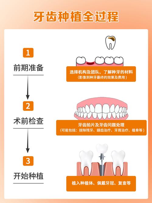 全口即刻种牙需满足哪些条件？适合人群有哪些？-图2