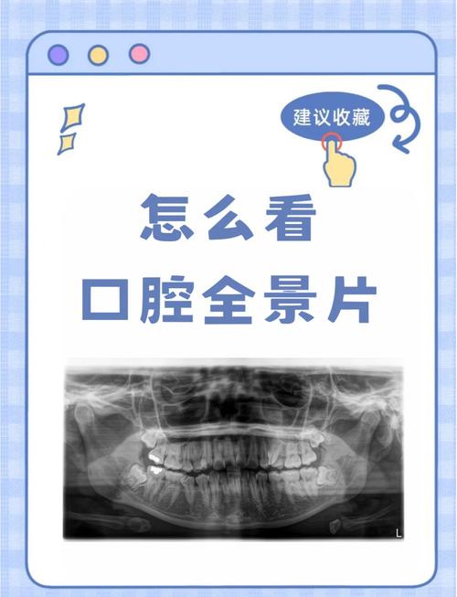 全口牙颌位记录方法有哪些?如何规范操作并确保精准记录?-图3 全口牙颌位记录方法有哪些?如何规范操作并确保精准记录?-图3