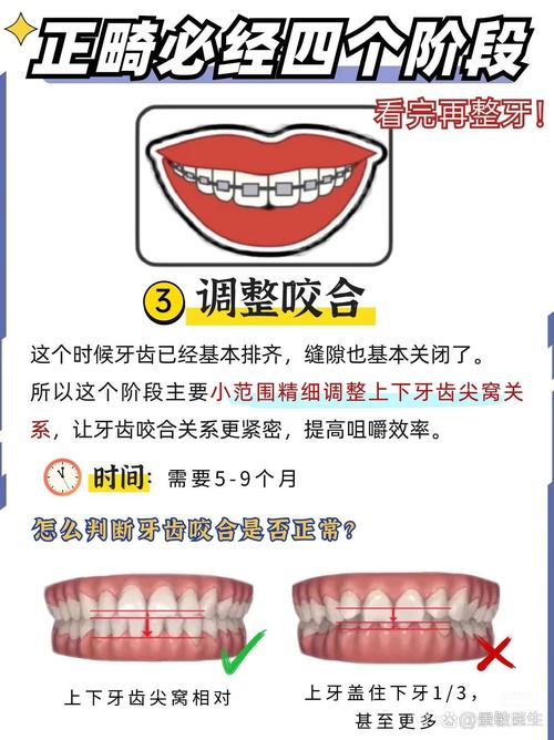 少侧切牙只正畸能矫正好吗?-图1 少侧切牙只正畸能矫正好吗?-图1