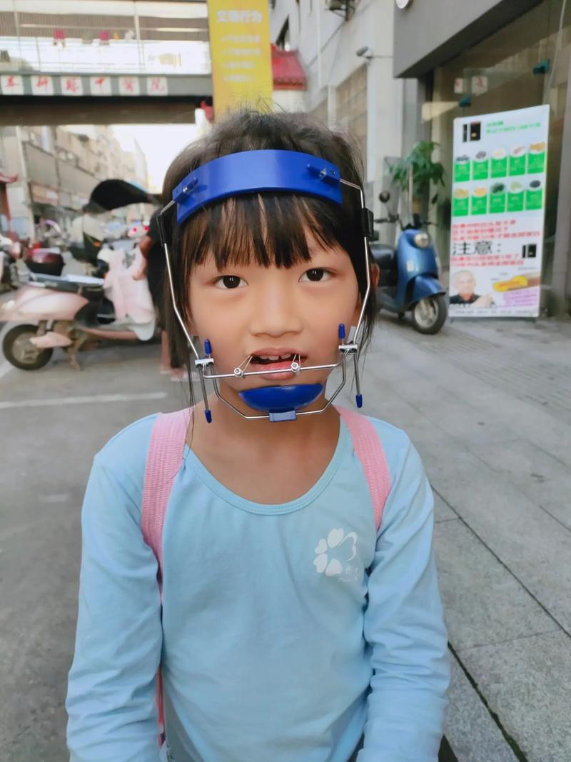 正畸牵引器正确戴法是什么？详细步骤有哪些？-图3