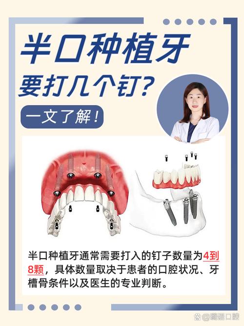 东城区口腔医院是否开展种植牙项目?技术好不好?价格如何?-图2 东城区口腔医院是否开展种植牙项目?技术好不好?价格如何?-图2