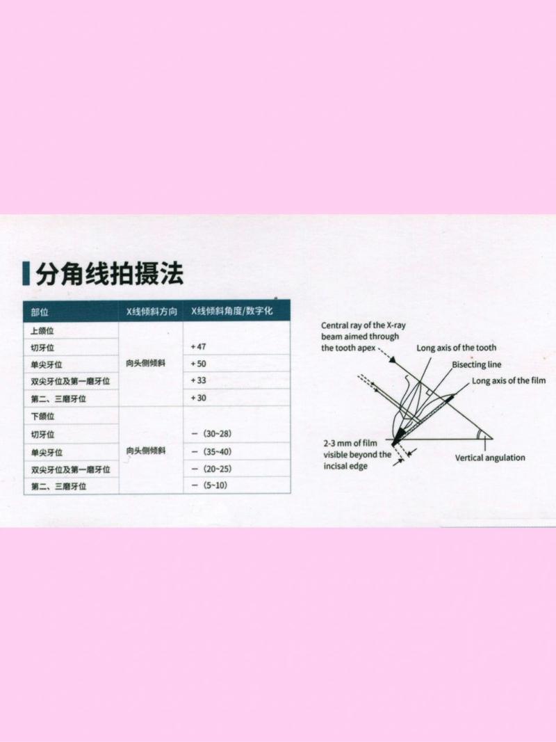 口腔科X线拍摄方法如何选择?不同类型的关键步骤与注意事项?-图1 口腔科X线拍摄方法如何选择?不同类型的关键步骤与注意事项?-图1