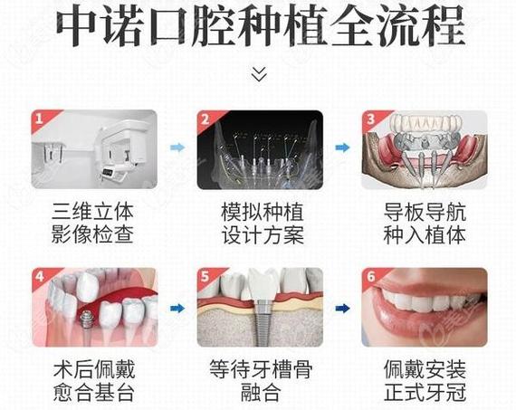 北京医院种牙价格表具体是多少？不同医院差异大吗？-图1