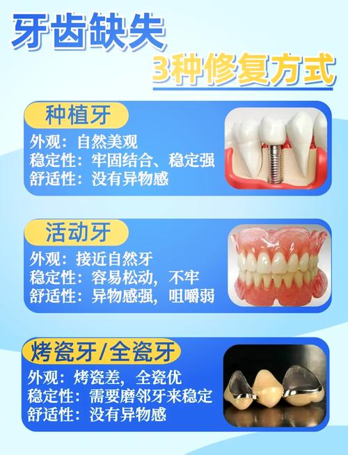 没门牙用哪种方法好-图1 没门牙用哪种方法好-图1