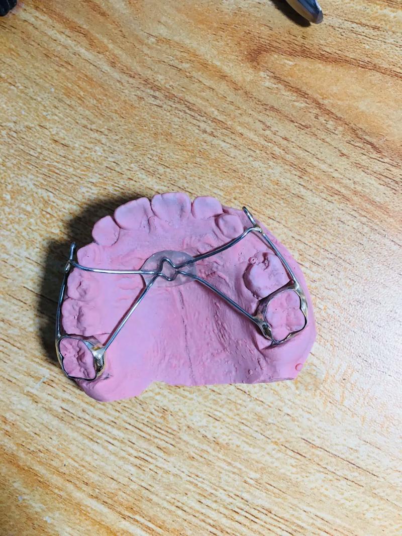 正畸前方牵引器图片展示了哪些佩戴和使用要点？-图2