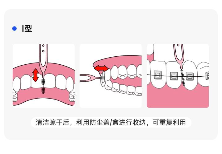 前牙牙间刷使用方法-图1