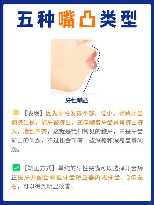 正畸骨性错颌的分类依据和类型有哪些?-图3 正畸骨性错颌的分类依据和类型有哪些?-图3