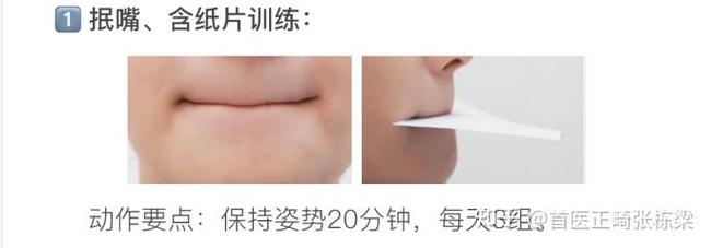 正畸者唇肌训练方法有哪些科学有效的具体步骤？-图1