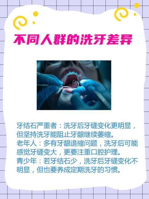 牙缝宽最好处理方法是什么?哪种方式更安全有效?-图1 牙缝宽最好处理方法是什么?哪种方式更安全有效?-图1