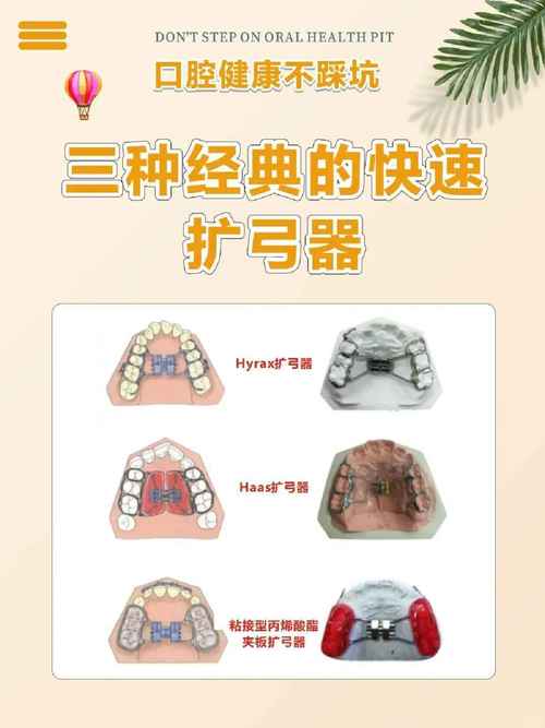 口腔正畸秒弓弯矫正法是什么？原理效果如何？-图2