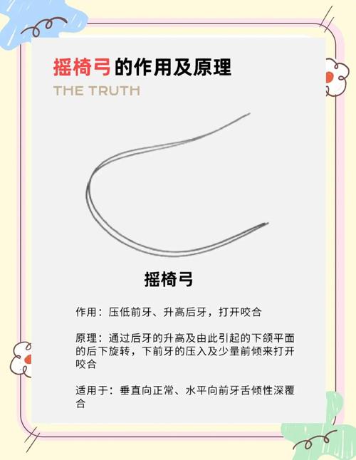 口腔正畸秒弓弯矫正法是什么？原理效果如何？-图3