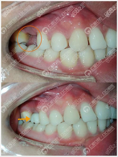 武汉种牙承喏仁爱f-图1