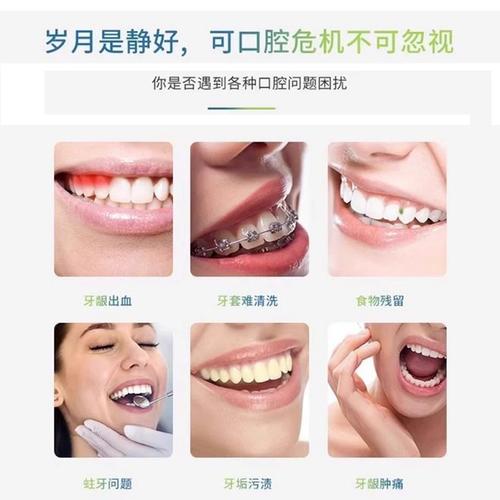 正畸牙齿需要冲牙器吗-图2 正畸牙齿需要冲牙器吗-图2