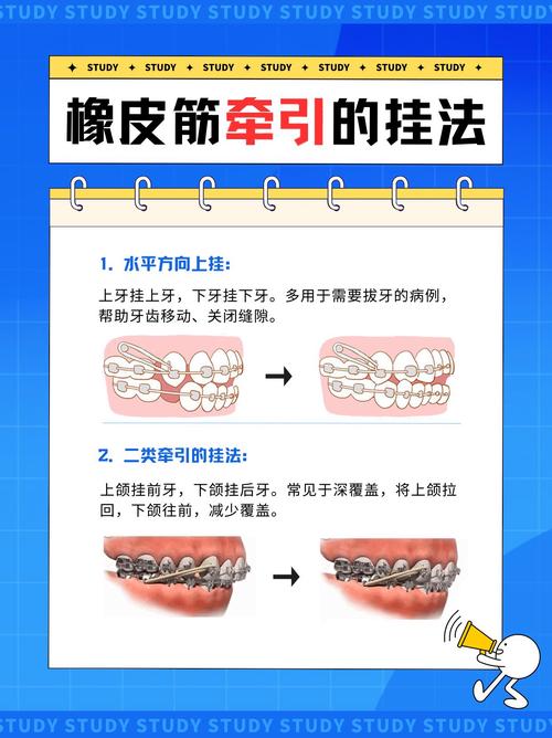 矫正橡皮圈使用方法-图1 矫正橡皮圈使用方法-图1