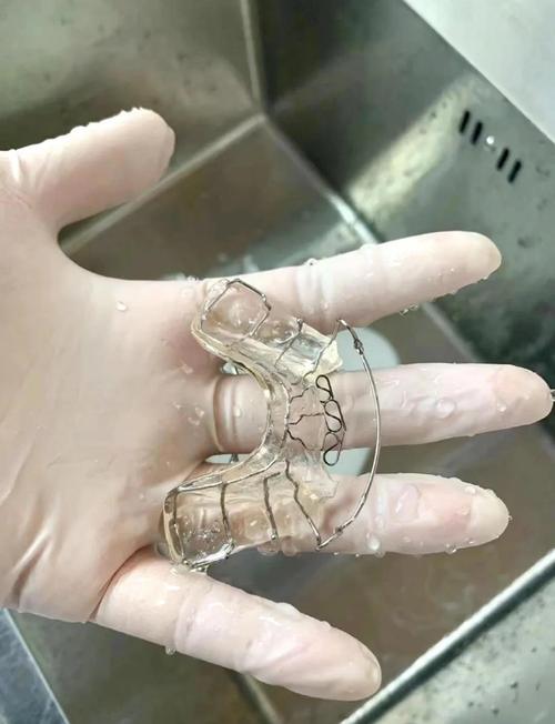 正畸颌垫的制作方法-图1 正畸颌垫的制作方法-图1