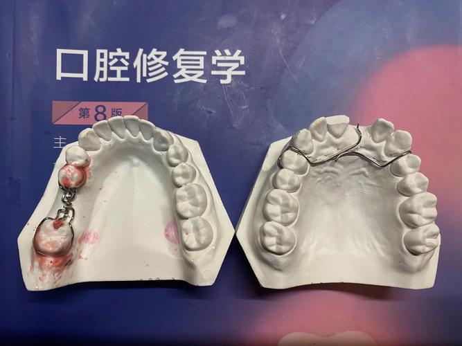 口腔科弯制卡环方法的关键步骤有哪些？-图2