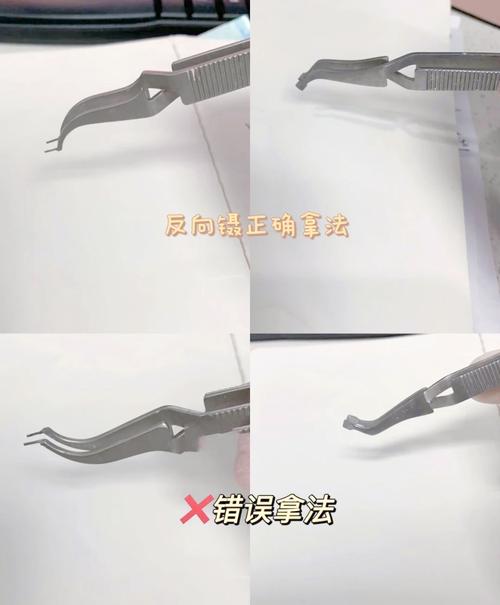 正畸粘托槽时注意事项-图1