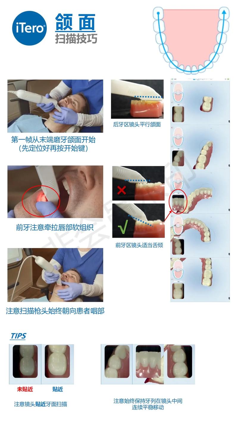 口腔检测仪使用方法-图1