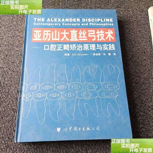 亚历山大正畸技术有哪些优势是传统技术不具备的?-图3 亚历山大正畸技术有哪些优势是传统技术不具备的?-图3