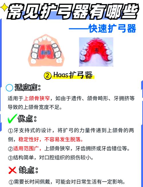 根管扩大仪使用方法-图2 根管扩大仪使用方法-图2