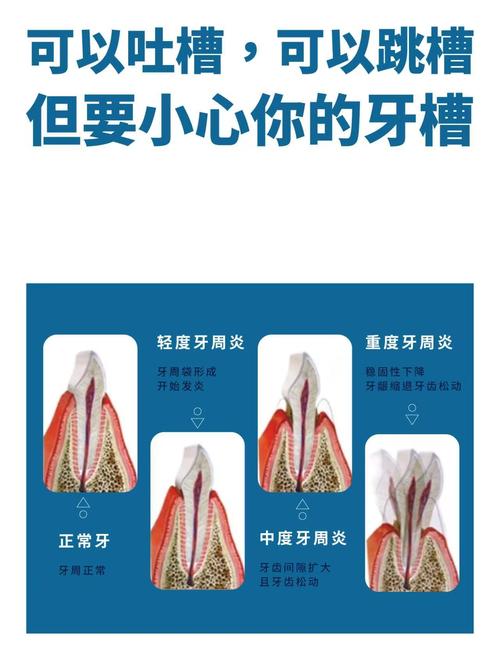 种牙后牙槽骨会发生吸收吗?-图1 种牙后牙槽骨会发生吸收吗?-图1