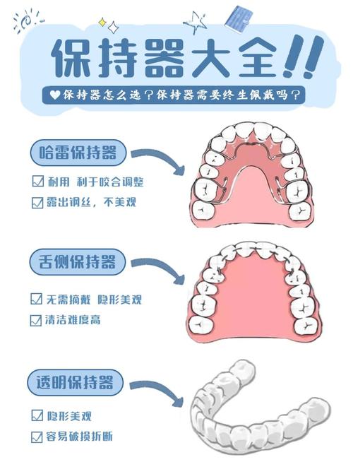 正畸后期多久能拆牙套-图1 正畸后期多久能拆牙套-图1