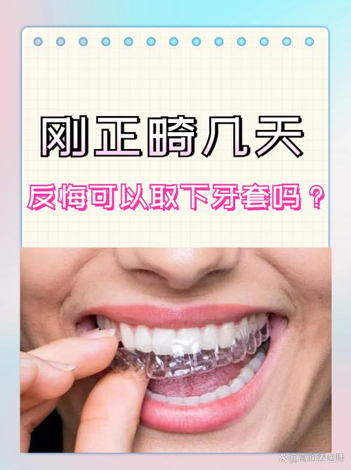 正畸后期多久能拆牙套-图3 正畸后期多久能拆牙套-图3