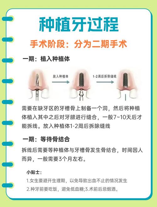 植种牙禁忌什么意思-图2