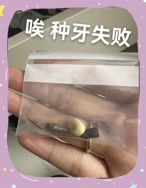 种牙后会出现哪些不良反应?这些症状需如何科学应对?-图1 种牙后会出现哪些不良反应?这些症状需如何科学应对?-图1