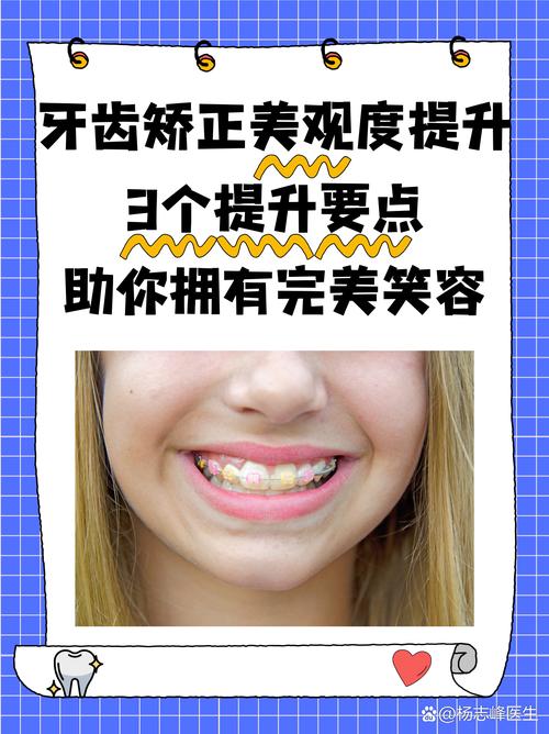 牙齿舌倾矫正有哪些方法？如何选择最适合的方案？-图3