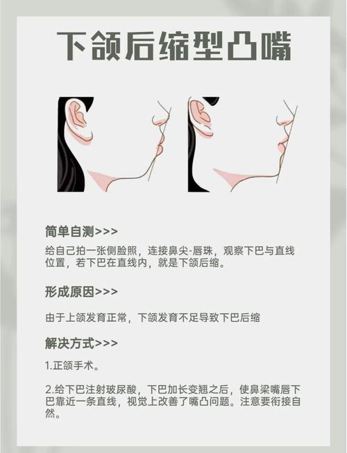 自己能改善反颌吗?有哪些实用方法可行?-图1 自己能改善反颌吗?有哪些实用方法可行?-图1