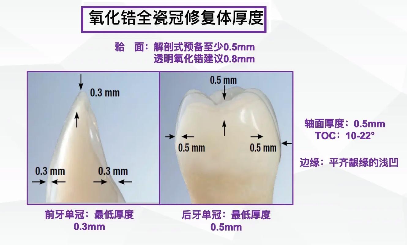烤瓷牙预备的方法步骤具体有哪些操作要点？-图2