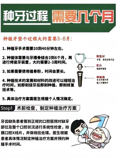 植骨后要等多久才能种牙?最佳种植时间是什么时候?-图1 植骨后要等多久才能种牙?最佳种植时间是什么时候?-图1