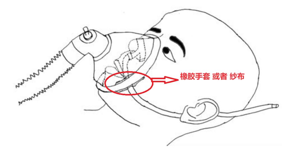 下颌铰链轴固定方法如何选择与操作以保障稳定性?-图1 下颌铰链轴固定方法如何选择与操作以保障稳定性?-图1