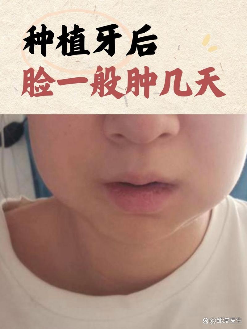 种牙后出现什么问题-图3