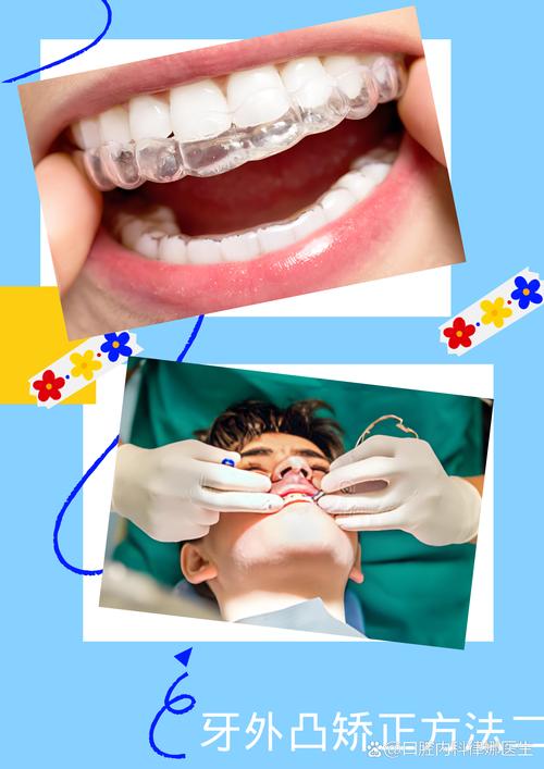 外国人都做牙齿正畸吗-图1 外国人都做牙齿正畸吗-图1