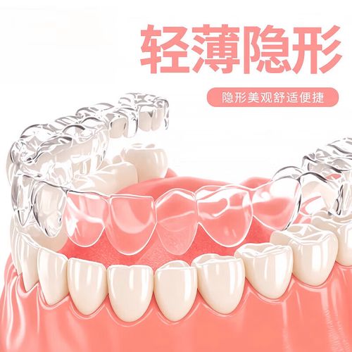 成人龅牙正畸多长时间-图2