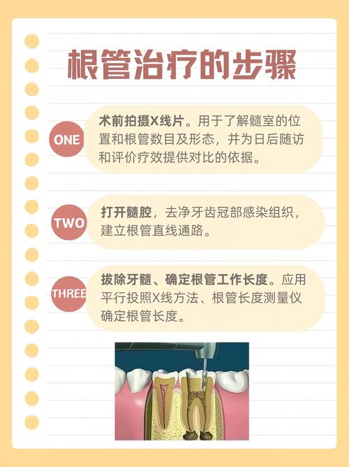 龋齿痛牙医治疗方法-图1 龋齿痛牙医治疗方法-图1