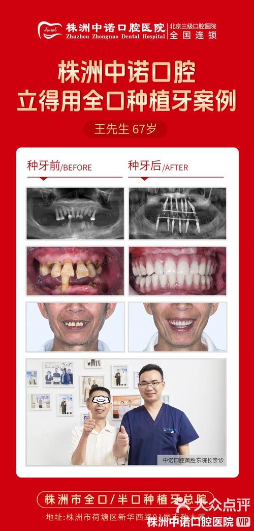 种满口牙能报医疗吗-图2 种满口牙能报医疗吗-图2